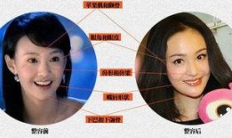 整容女星爆料视频