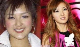 整容女星爆料视频